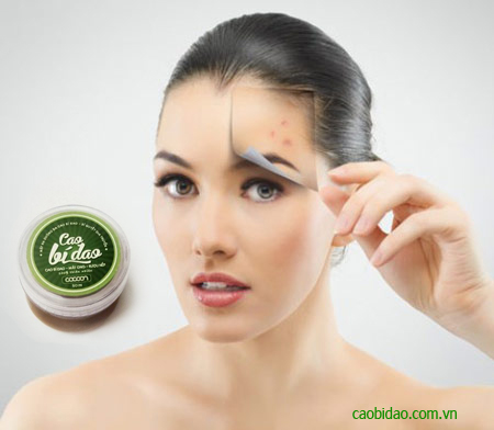 Cao Bí Đao Trị Mụn đỏ đỏ cao bí đao trị mụn đỏ đỏ